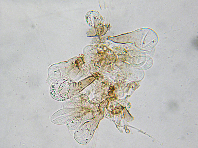 Coprinus-auricomus-29-Pileocistidi-Acqua.jpg