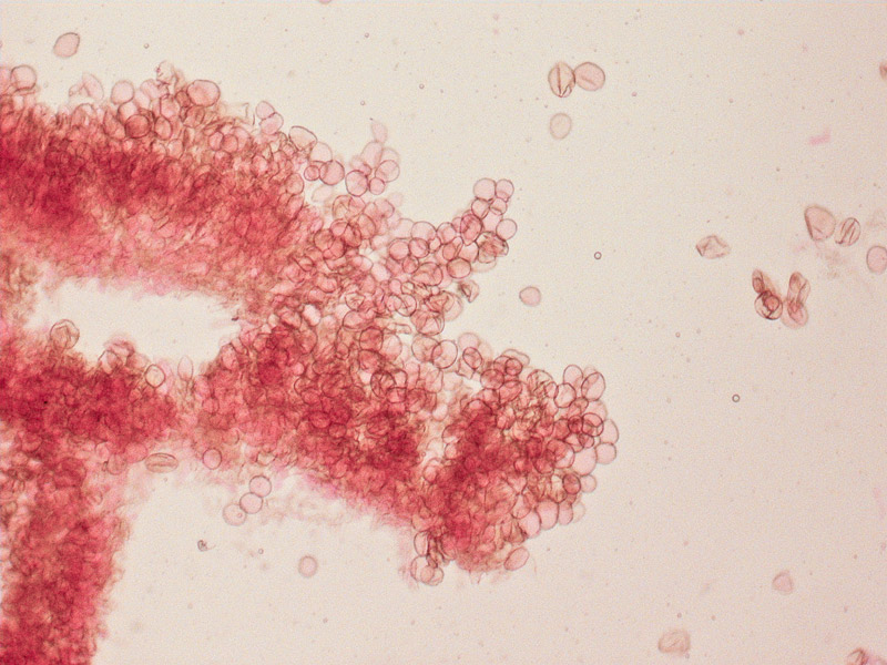 Cystoderma-jasonis-06_Cuticola.jpg
