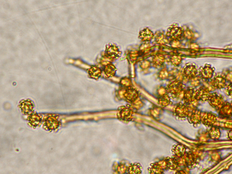 Myriostoma coliforme 41 Capillizio Spore Melzer.jpg