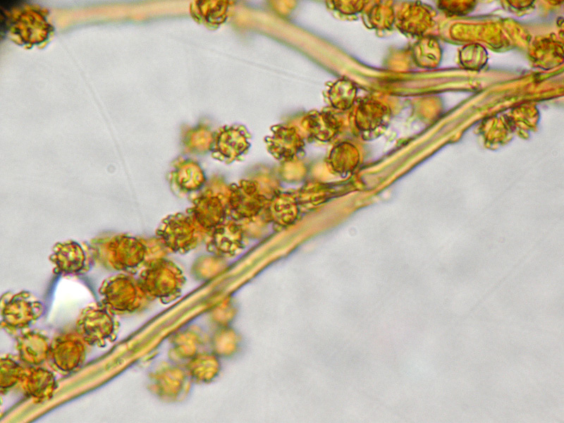 Myriostoma coliforme 38 Capillizio Spore Melzer.jpg