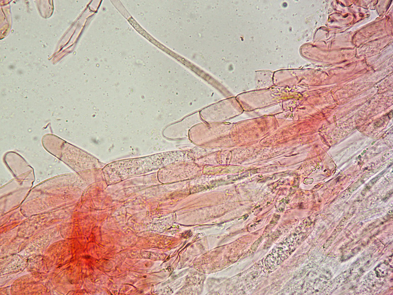 Entoloma-incarnatofuscescens-50-Cuticola-400x.jpg