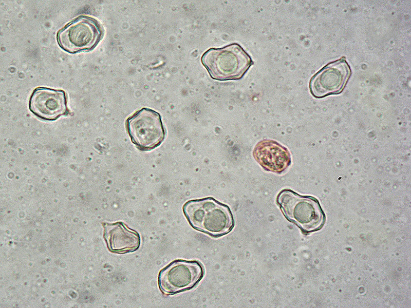 Entoloma-incarnatofuscescens-31-7-Spore-1000x.jpg