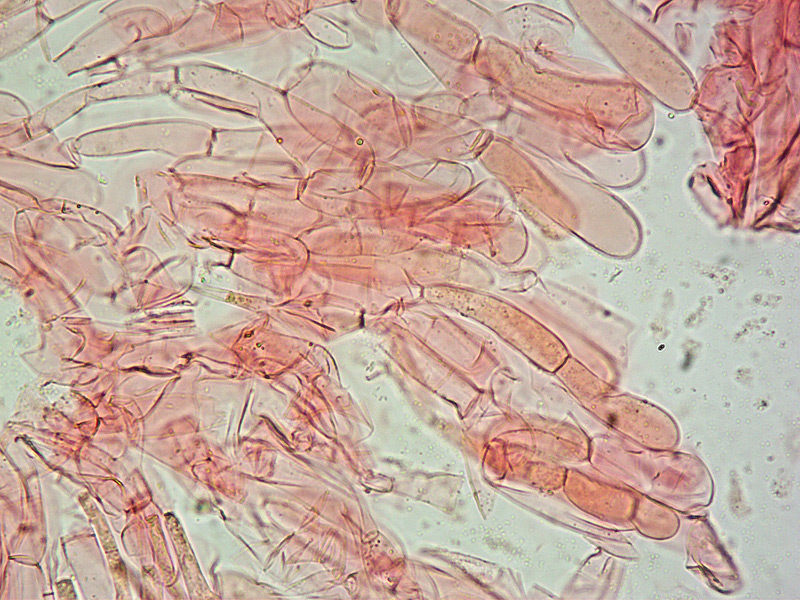 Entoloma-incarnatofuscescens-56-Cuticola-400x.jpg