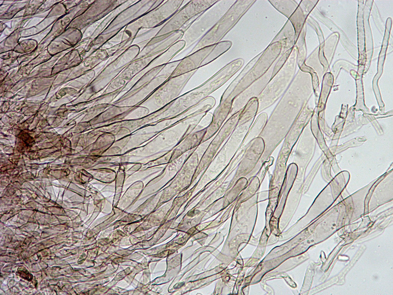 Lepiota-griseovirens-16-7-Cuticola-e-subcouche-400x-L4.jpg