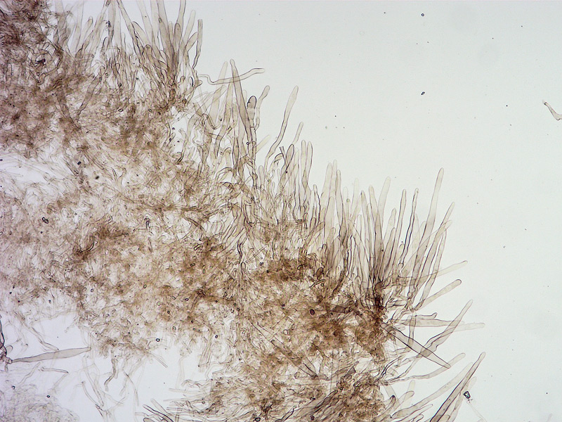 Lepiota-griseovirens-08-Cuticola-e-subcouche-100x-L4.jpg
