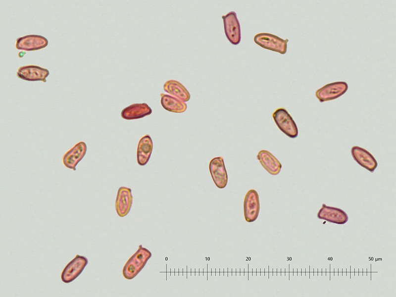 Lepiota-griseovirens-22-30-Spore-speronate-1000x-RC_m.jpg