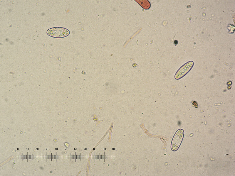 Sarcoscypha-coccinea-14-Spore-400x-RC.jpg