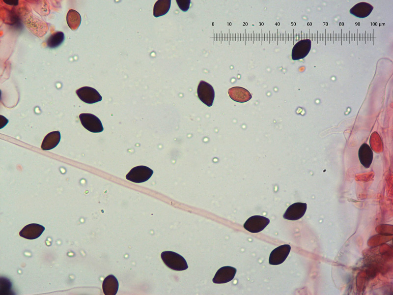Panaeolus-papilionaceus-10-Spore-400x-RC.jpg