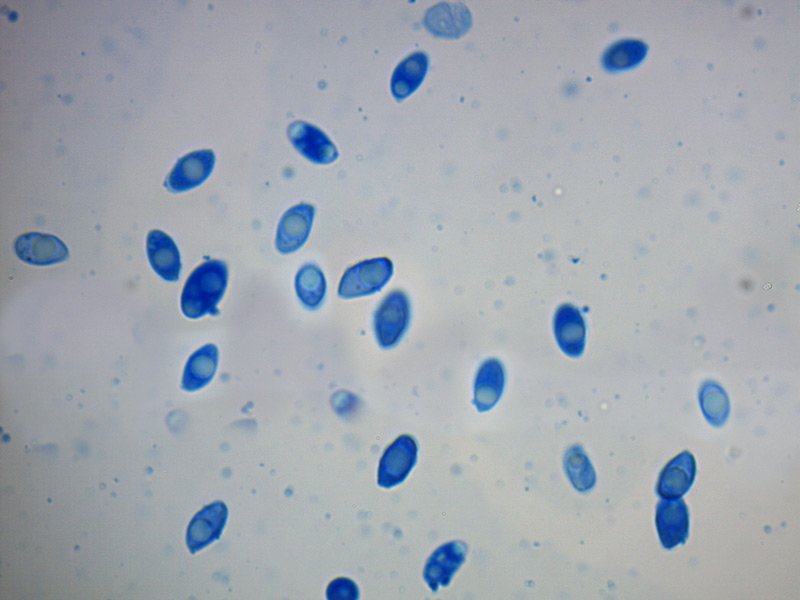 L-maleolens-spore-cianofile-1_1000.jpg