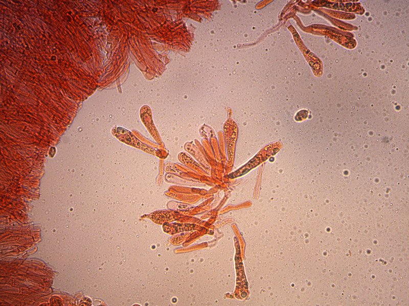 tricholoma-luridum-basidi-4_400.jpg