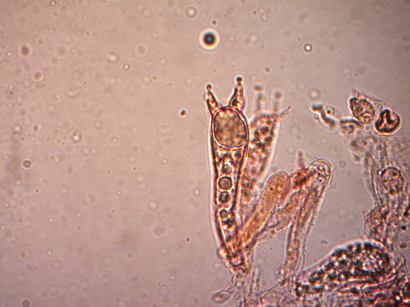 tricholoma-luridum-basidi-5_1000.jpg
