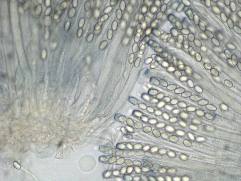 Peziza micropus 15 Aschi spore Melzer 400x.jpg