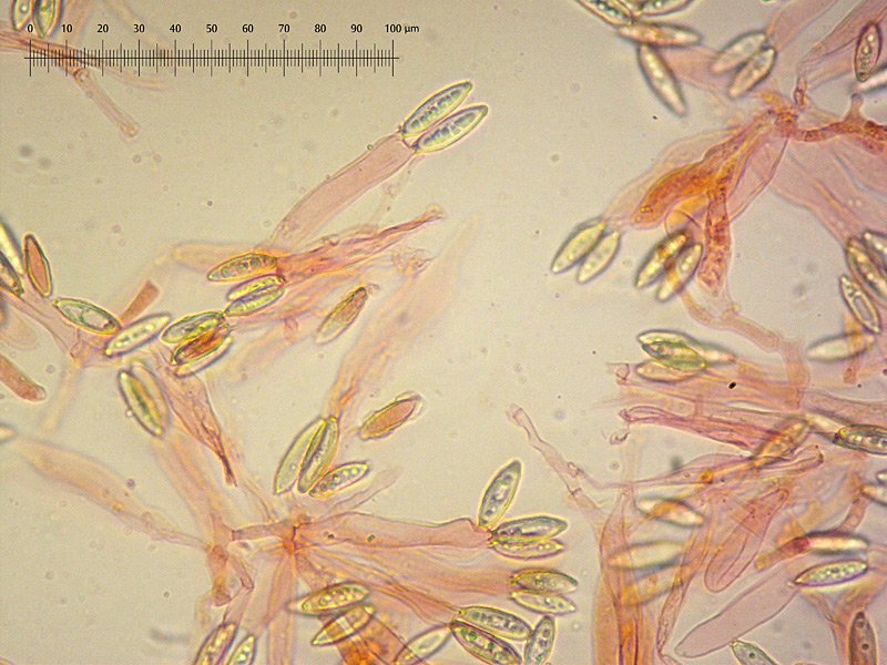 Hysterangium stoloniferum 25 Lorenzo Rossi - Basidi Spore RC 400x um.jpg