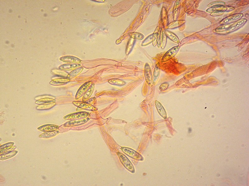 Hysterangium stoloniferum 23 Basidi Spore 400x RC.jpg