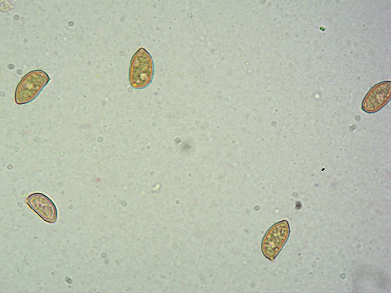 Inocybe-splendens-var-phaeoleuca-44-Spore-RC-1000x.jpg