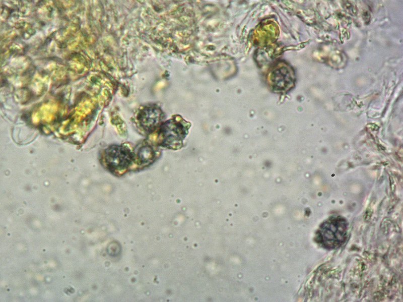 Lactarius turpis 23-4 Spore Melzer 1000x.jpg