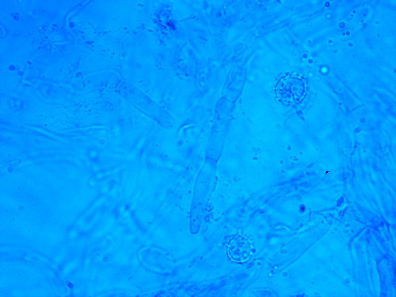 Russula insignis 53 Dermatocistidi 1000x Blu Cresile Brillante.jpg