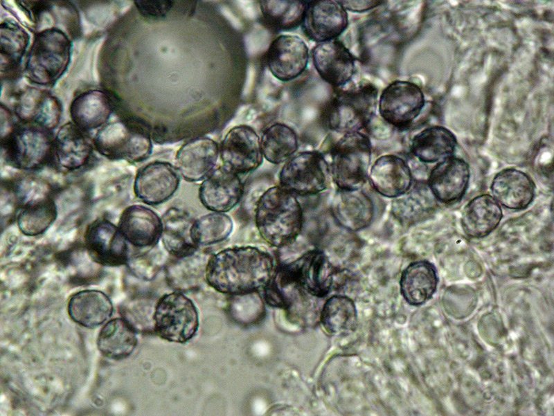 Lactarius salmonicolor 15-9 Spore 1000x Melzer e Cloralio idrato.jpg