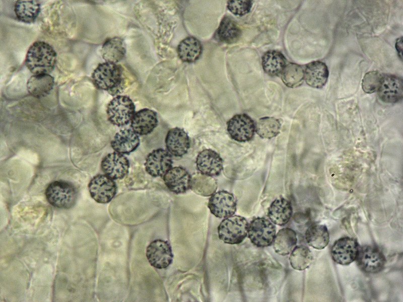Russula sez Puellarinae 30-2 Spore 1000x Melzer e Cloralio idrato.jpg