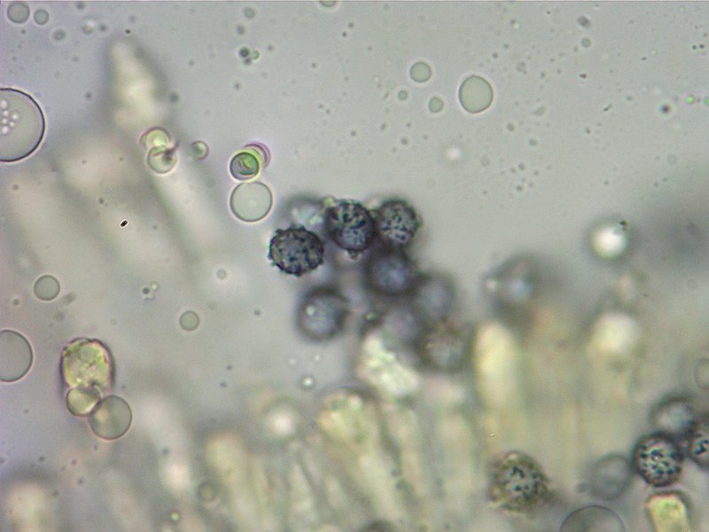 Russula insignis 07-10 Spore 1000x Melzer e Cloralio idrato.jpg