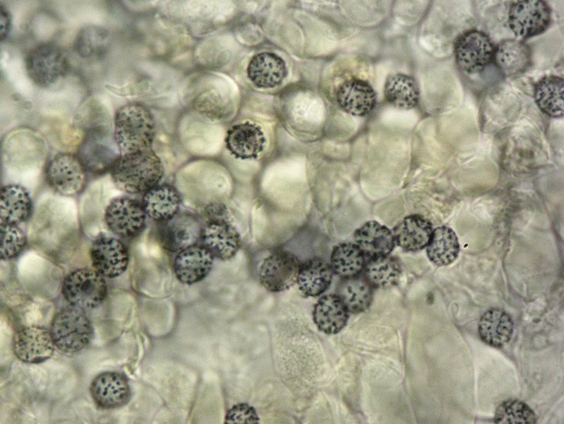 Russula sez Puellarinae 27-8 Spore 1000x Melzer e Cloralio idrato.jpg