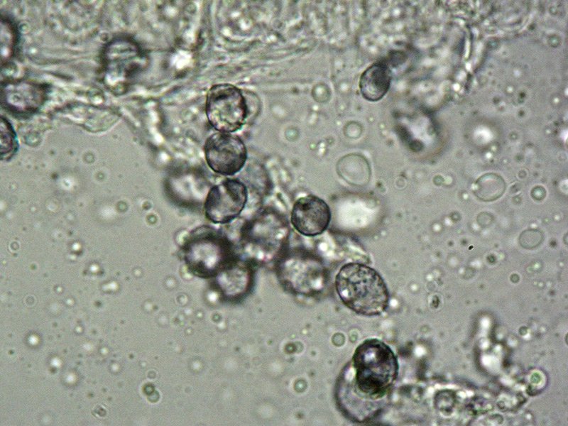 Lactarius salmonicolor 12-4 Spore 1000x Melzer e Cloralio idrato.jpg