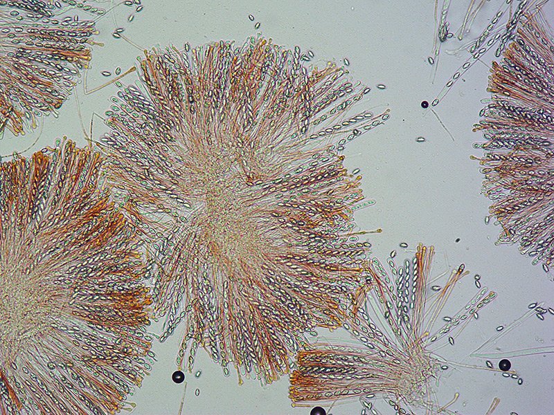 Aleuria-aurantia-08-Aschi-spore-parafisi-100x-RC.jpg