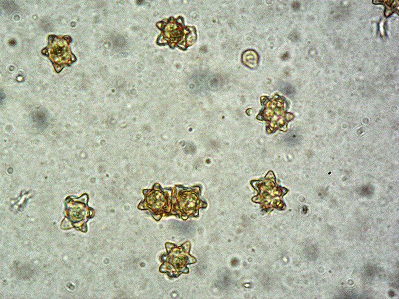 Inocybe-asterospora-13-Spore-1000x-RC.jpg