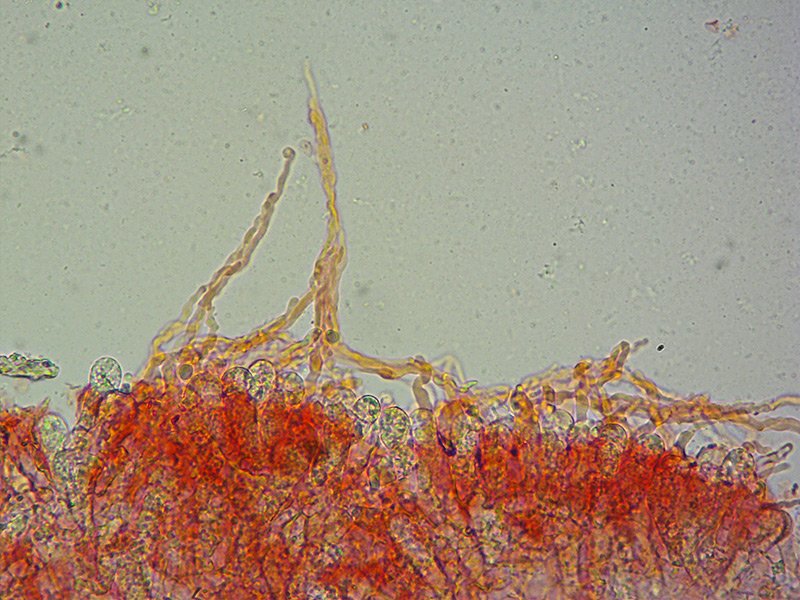 Lyophyllum-paelochroum-18-Cellule-marginali-400x-RC.jpg