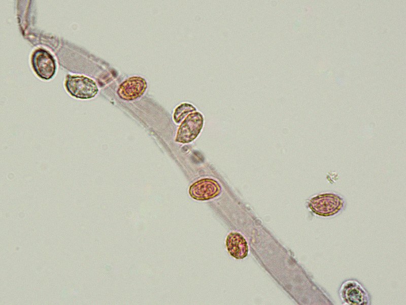 Melanoleuca friesii 32b Spore 1000x RC.jpg
