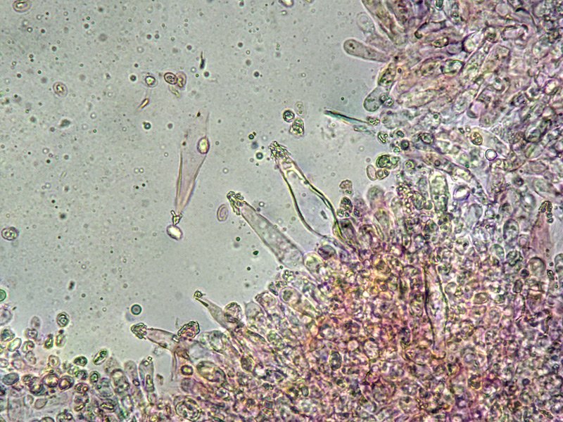 Melanoleuca friesii 26-7 Cheilo 400x RC.jpg