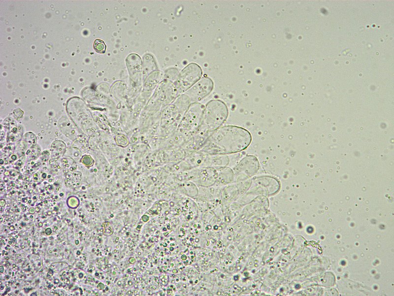 Entoloma roseum O TL191121-07 11 Cheilo 400x L4.jpg