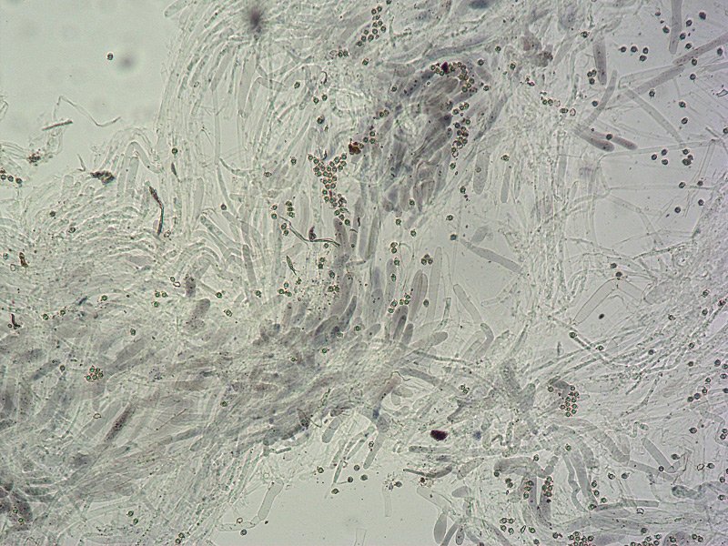 Entoloma serrulatum C TL191121-10 30 Pileipellis 100x L4.jpg