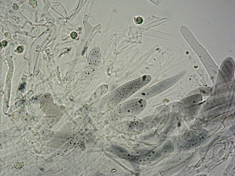 Entoloma serrulatum C TL191121-10 39 Pileipellis 400x L4.jpg