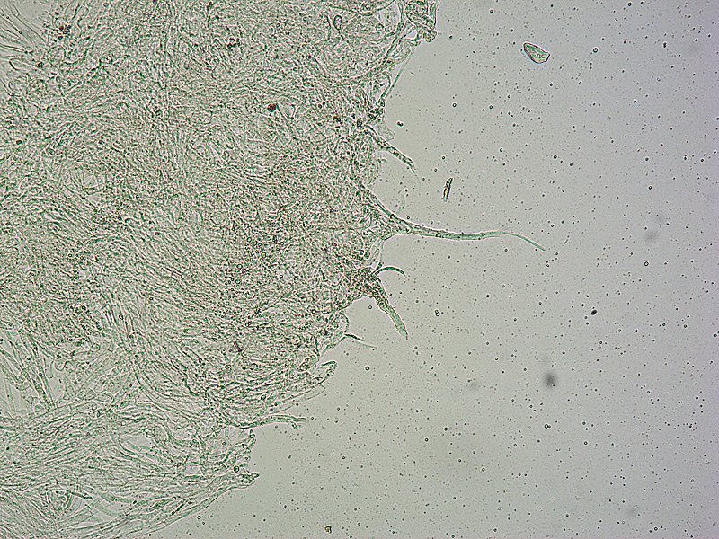 Entoloma roseum O TL191121-07 33 Pileipellis 100x L4.jpg
