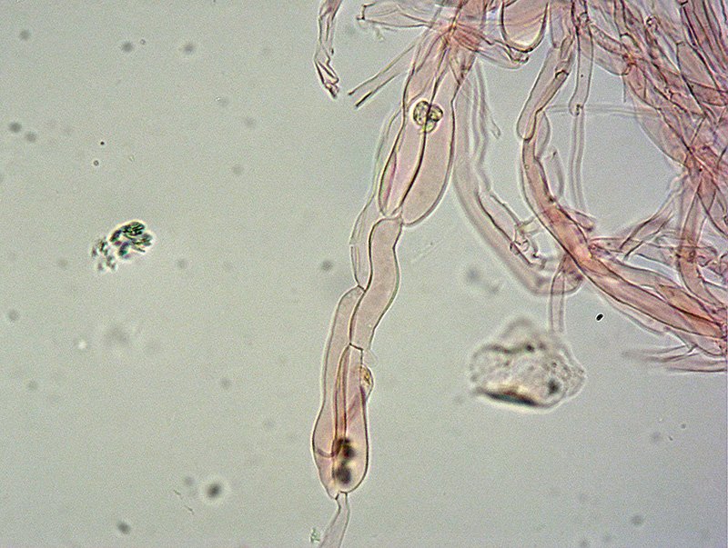 Cuphophyllus-fornicatus-TL191228-01-34-7-8-Ife-trama-lamellare-400x-RC.jpg