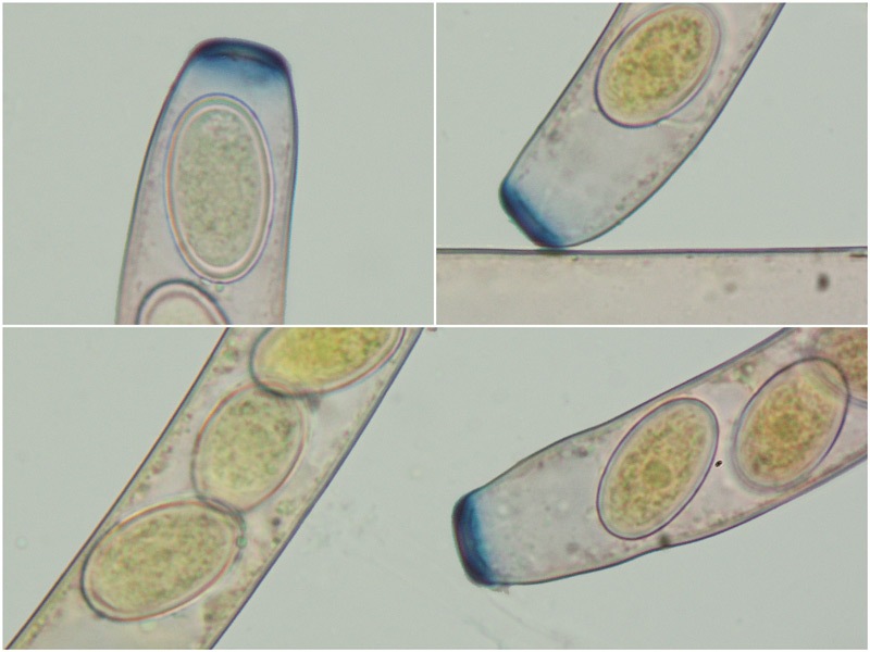 Peziza vesiculosa 53-4-5 Aschi Spore RC e Melzer 1000x.jpg