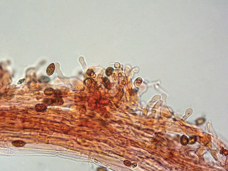 Paneolina foenisecii 28-9 Caulo RC 400x.jpg