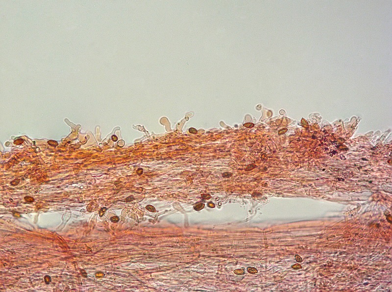 Paneolina foenisecii 17-20 Caulo RC 200x.jpg