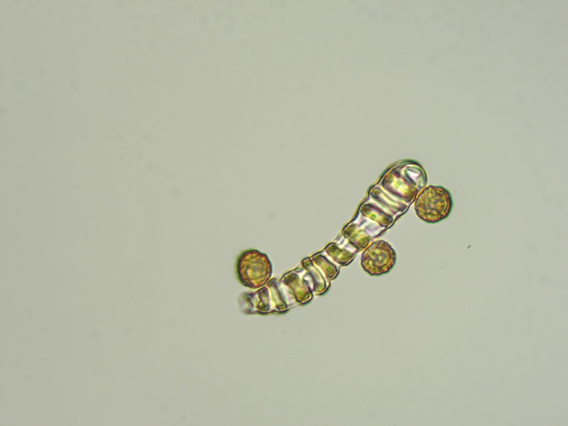 Battarrea-phalloides-13-Spore-Elateri-KOH-1000x.jpg