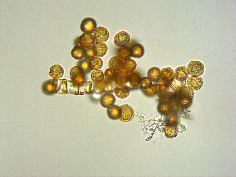 Battarrea-phalloides-18-Spore-Elateri-KOH-1000x.jpg