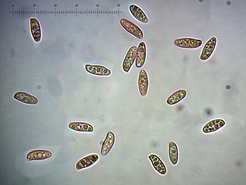 X-silwoodensis-spore-1_1000x.jpg