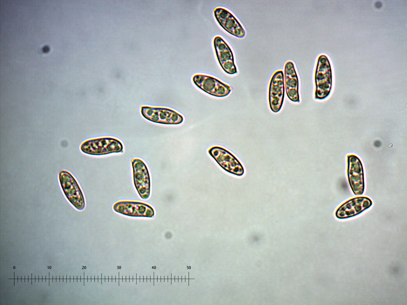 X-silwoodensis-spore-3_1000x.jpg