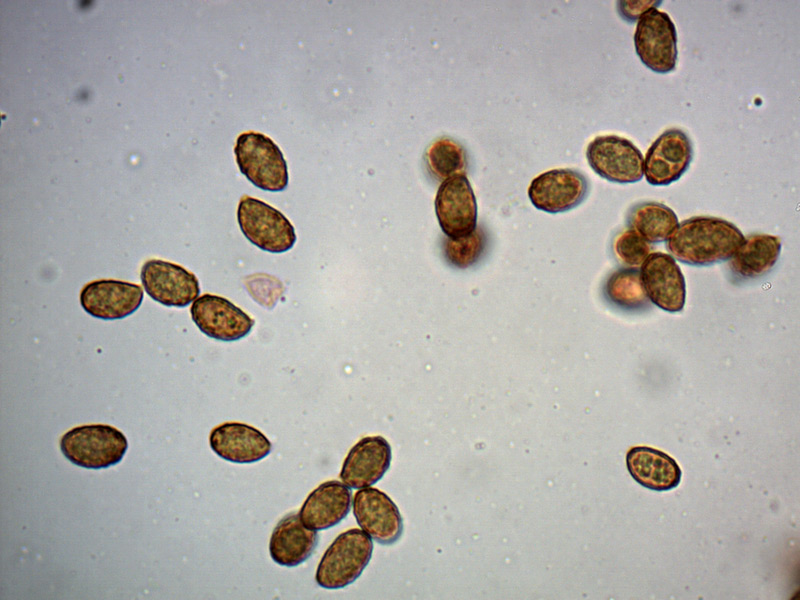 Cortinarius-subpurpurascens-spore-6_1000x.jpg