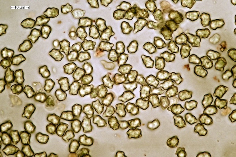 Spore gibbose  N= 50 ; (6,69)7,29-7,62-8,49(8,69) x (4,74)4,92-5,4-5,95(7,31) - Qm= 1,44.jpg