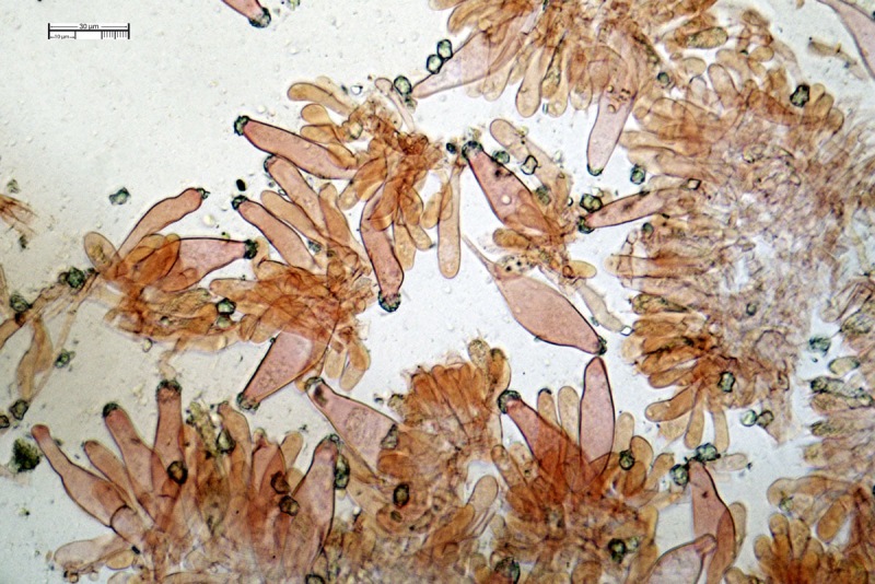 Cheilocistidi (47,30)47,73-56,82-70,07(73,07) x (11,57)12,24-19,275-19,53(20,91)bis.jpg