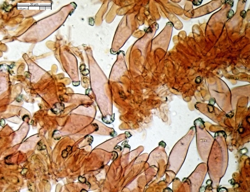 Cheilocistidi (47,30)47,73-56,82-70,07(73,07) x (11,57)12,24-19,275-19,53(20,91).jpg