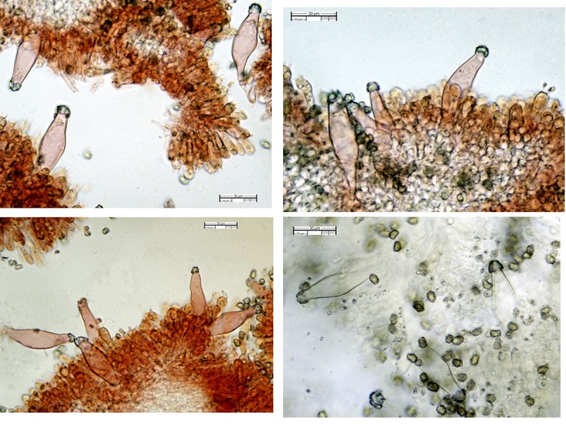 Pleurocistidi (51,51)53,53-70,125-72,86(73,50) x (13,92)14,20-16,92-21,93(22,66).jpg