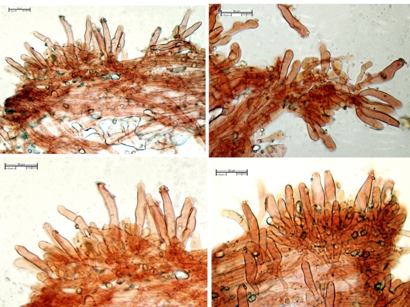 Caulocistidi esclusivamente apicali (41,74)44,46-51,235-60,72(61,20) x (8,36)8,41-11,88-12,34(12,41).jpg