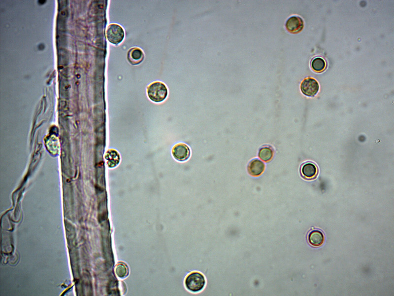 Lyophyllum-conglobatum-spore-17_1000x.jpg